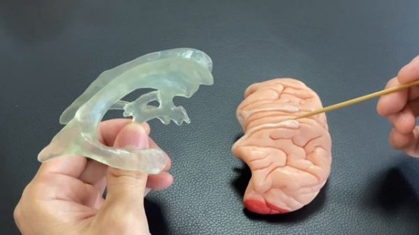 3 places where neurogenesis is happening (English)