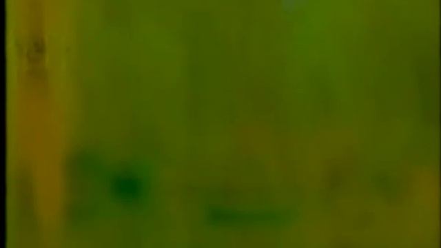 Зрение смотреть онлайн