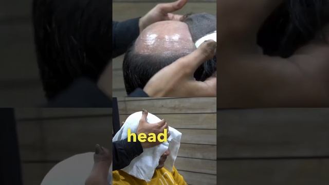 Hair Patch Service - Removal, Cleaning And Massage