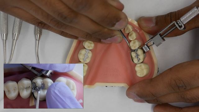 Amalgam Fill Restoration Walkthrough (tutorial) - Simulation Clinic Demonstration смотреть онлайн