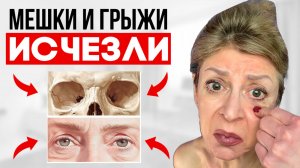 Это невероятно! Остеопатия уменьшает грыжи в 2 раза всего за 7 шагов!