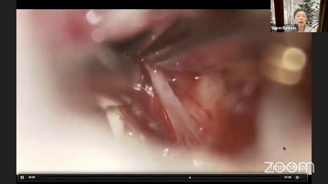 Dr. Asahikawa Medical University, Hokkaido, Japan смотреть онлайн