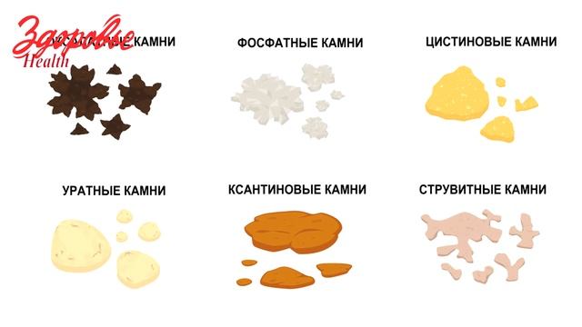 Métaphylaxie de la lithiase urinaire смотреть онлайн