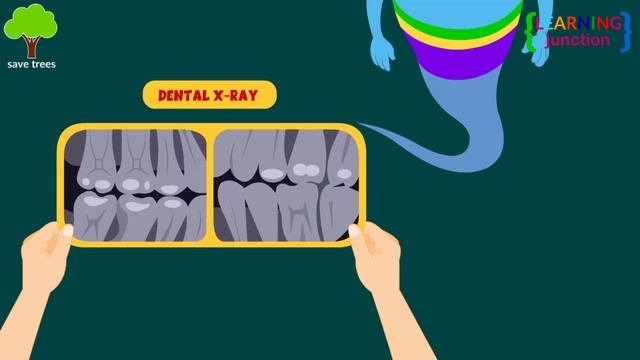 Tooth Decay: Symptoms, Causes, Treatment, and Prevention | Video for Kids | Learning Junction смотреть онлайн