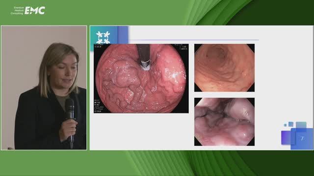 2. Подлипаева С.Г., Серков И.И., Сухов М.Н. Варикозное расширение вен пищевода и желудка у детей