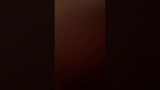 Вывихнул руку? ДА Я ВЫВИХНУЛ А НЕ СЛОМАЛ:(😭 смотреть онлайн