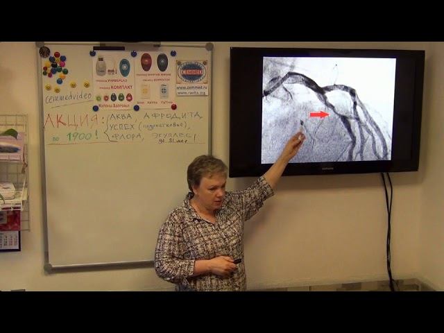 Сосуды.  Лечение и профилактика