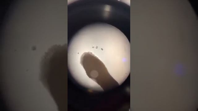 Tapeworm under the microscope - Veterinary Video смотреть онлайн