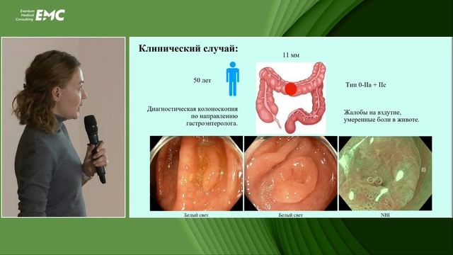 1 Гусева Е.В. Агейкина Н.В. Многоликие и удивительные ЗОШО. Инвертированное зубчатое новообразование