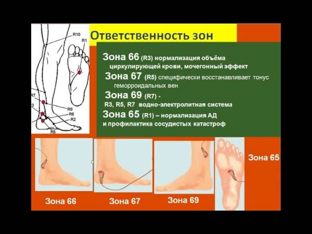 BioTrEM при заболеваниях сердечно-сосудистой системы