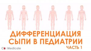 Сыпь в педиатрической практике: как правильно поставить диагноз при экзантемных заболеваниях?