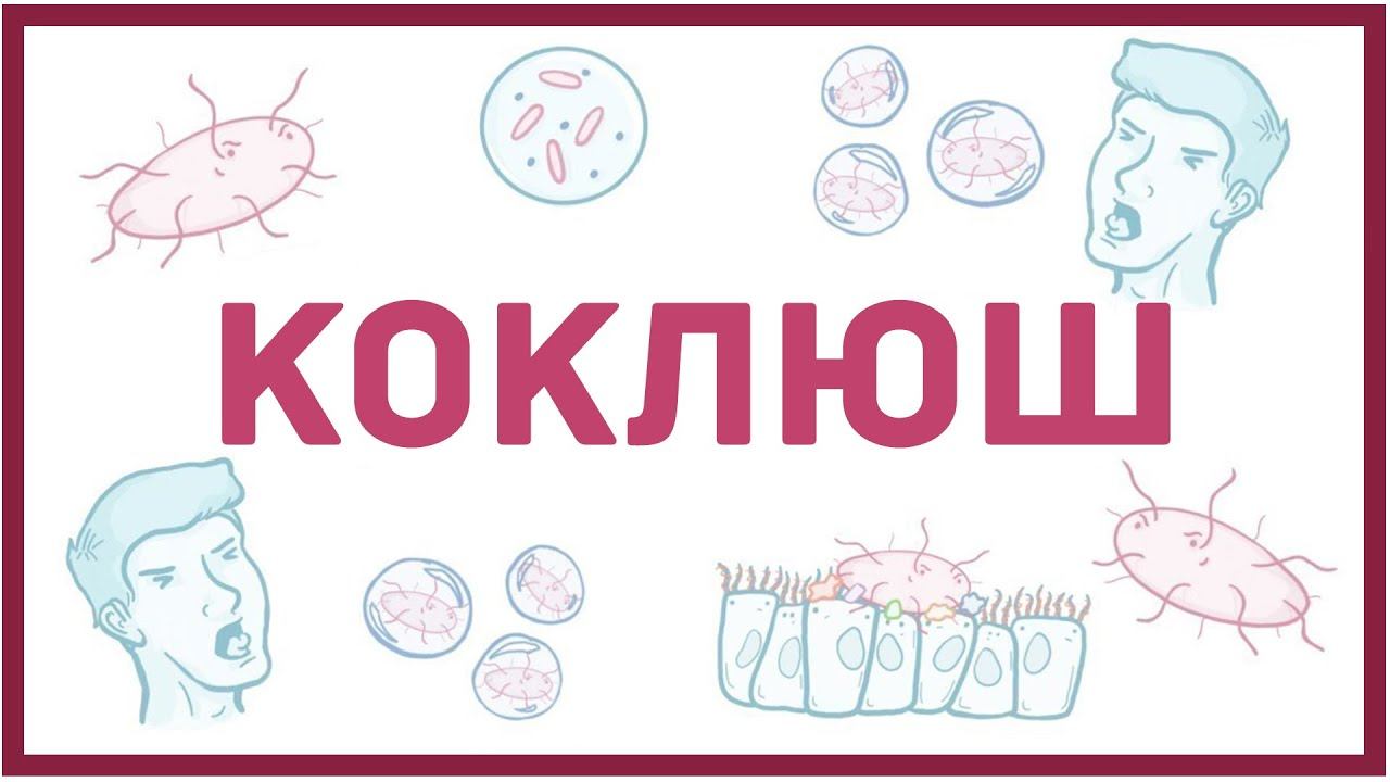 Коклюш - причины, симптомы, диагностика, лечение смотреть онлайн