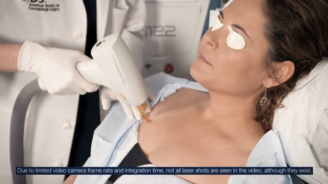 Lumenis M22 Q-Switched Patient Treatment #2 смотреть онлайн