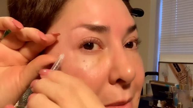 Aplicación de Botox en contorno de ojos -2 смотреть онлайн