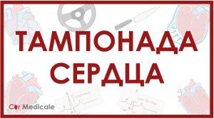 Тампонада сердца