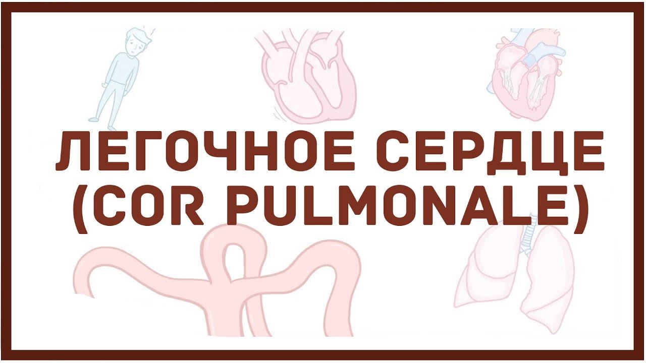 Легочное сердце - причины, симптомы, диагностика, лечение смотреть онлайн
