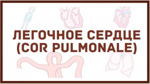 Легочное сердце - причины, симптомы, диагностика, лечение