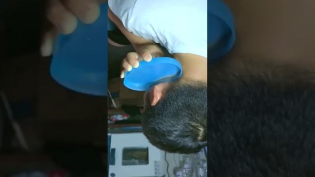 REMOVAL OF 5 FILTERS FROM EAR CANAL & MORE EAR WAX REMOVALS