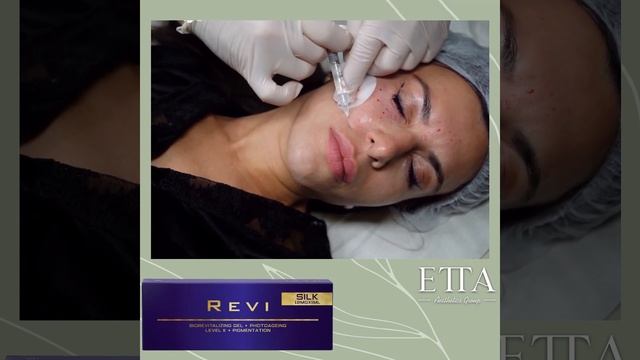 revi silk смотреть онлайн