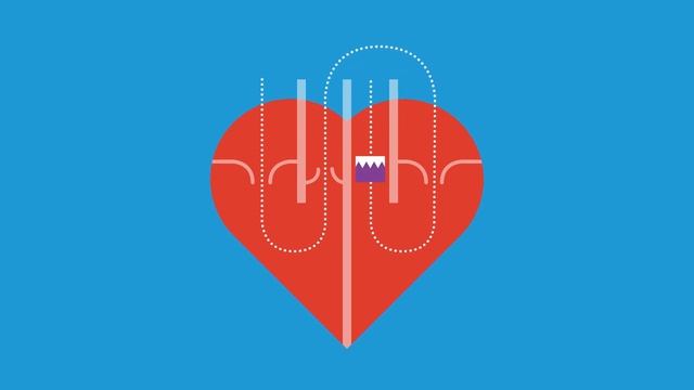 Aortic Stenosis смотреть онлайн