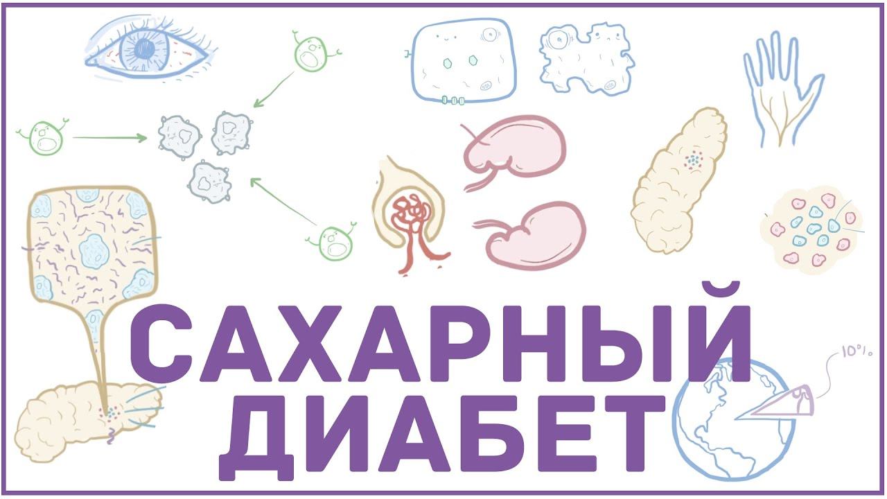 Сахарный диабет - 1 и 2 тип, причины, симптомы, кетоацидоз, гиперосмолярная гипергликемия смотреть онлайн