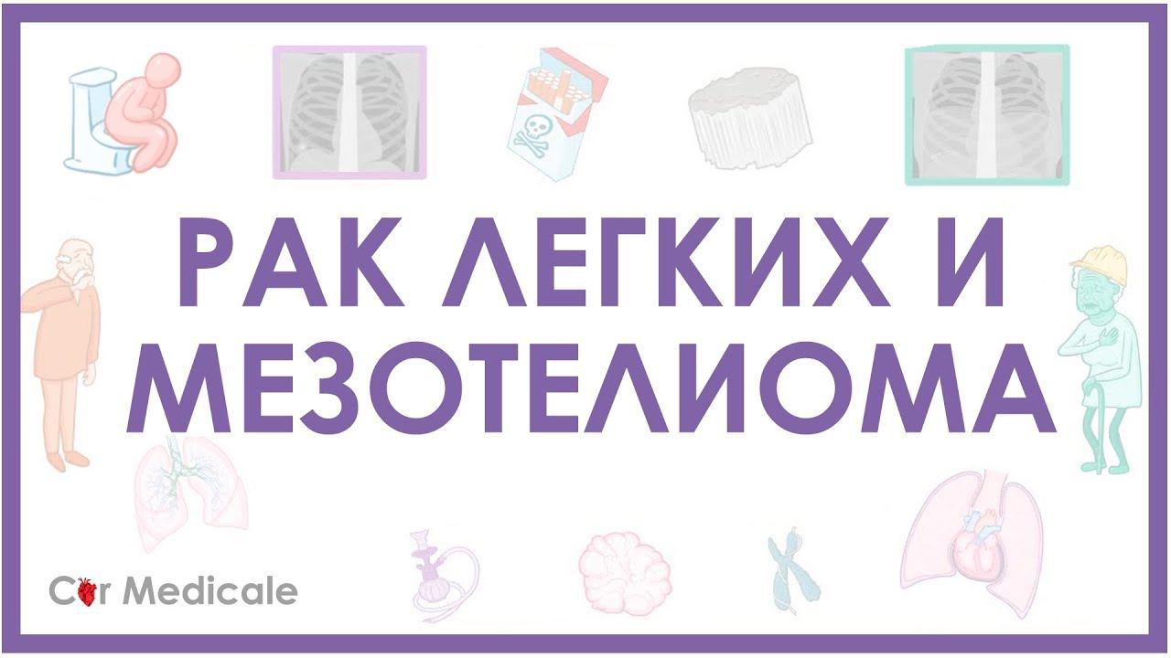 Рак легких и мезотелиома - причины развития, дифференциальная диагностика, принципы лечения и др. смотреть онлайн