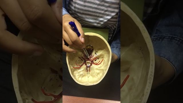 Blood Supply Of Brain “ Model 2 “ .