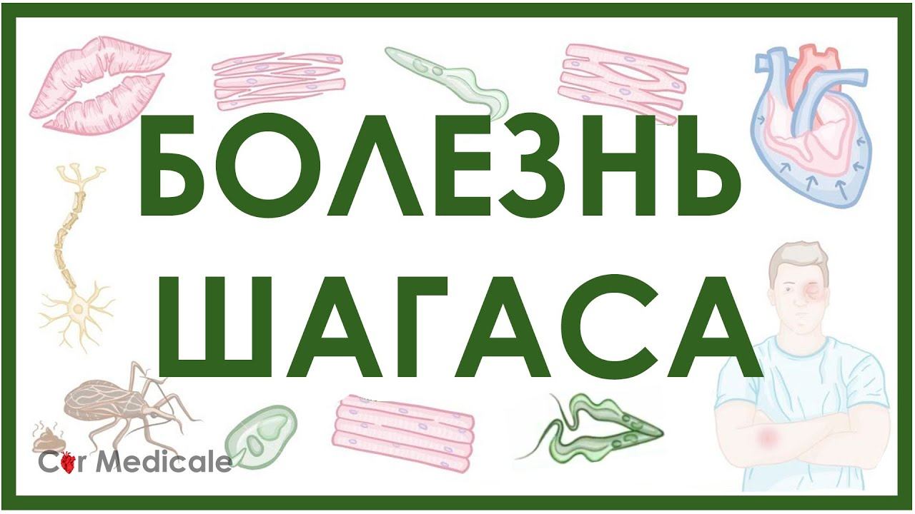 Трипаносомоз - Болезнь Шагаса: цикл трипаносомы, механизм развития, проявления, принципы лечения смотреть онлайн