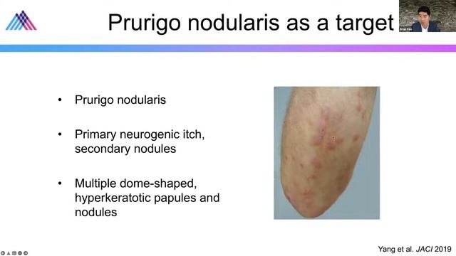Odland Lecture: Chronic Pruritus смотреть онлайн