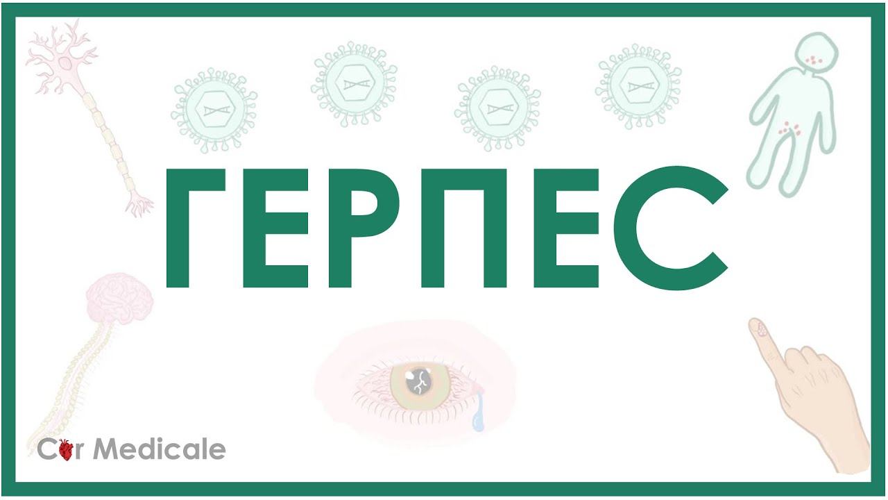 Герпес - причины, симптомы, диагностика смотреть онлайн