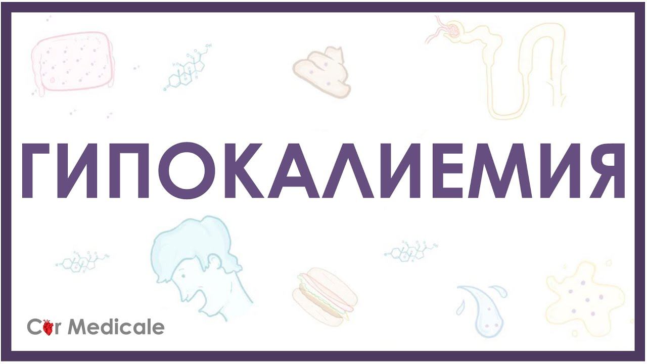 Гипокалиемия - причины, механизм развития, последствия, принципы устранения смотреть онлайн