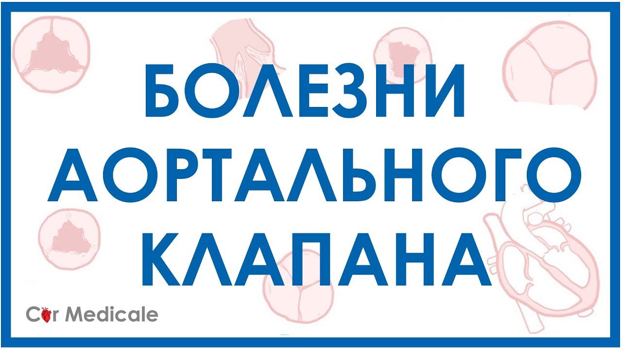 Болезни аортального клапана: аортальный стеноз, недостаточность аортального клапана. смотреть онлайн