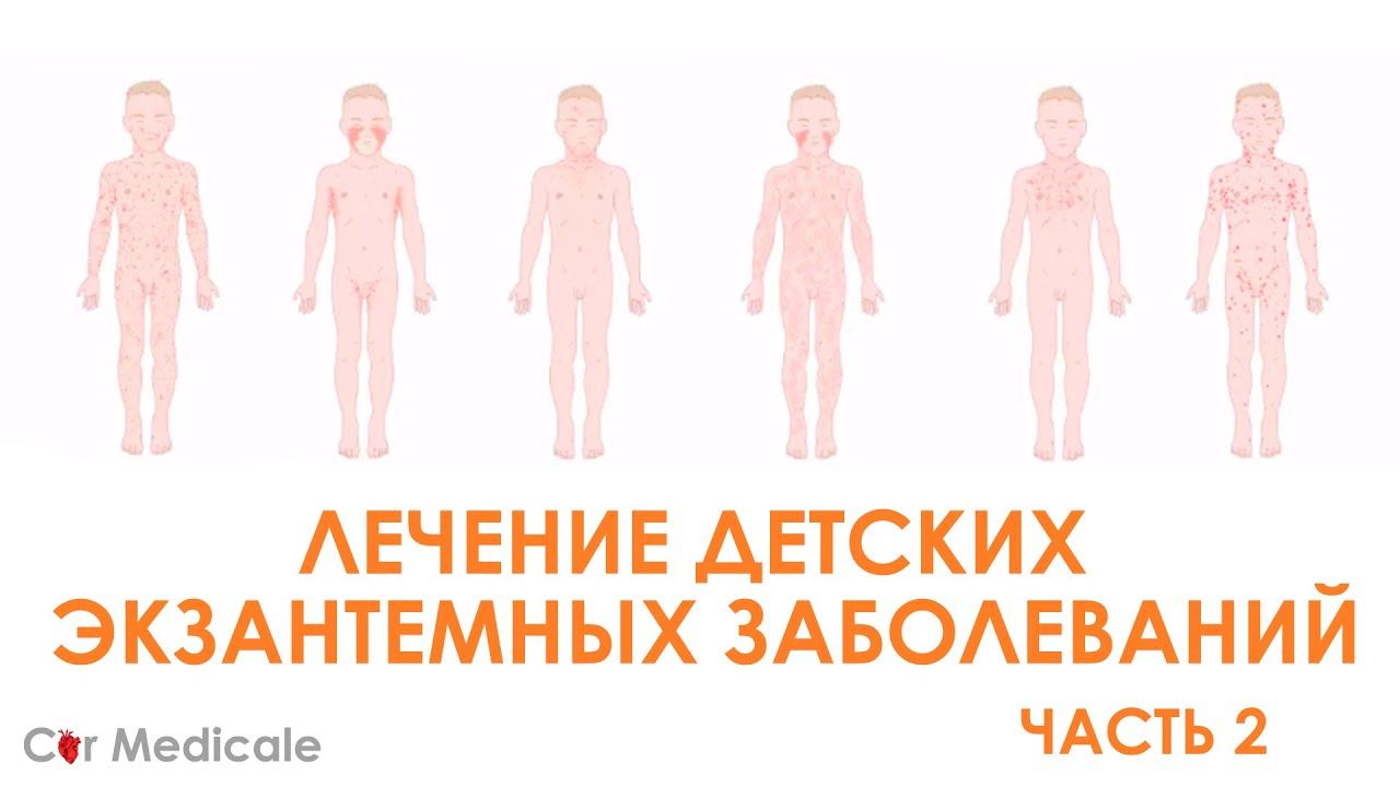 Сыпь в педиатрической практике: как лечить детские экзантемы? смотреть онлайн