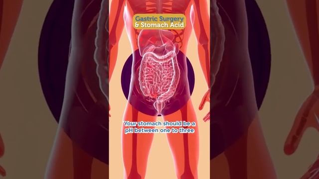 Gastric surgery & stomach acid Here's the thing...for optimal digestion you NEED Stomach Acid! But смотреть онлайн