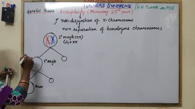 Turner's Syndrome смотреть онлайн