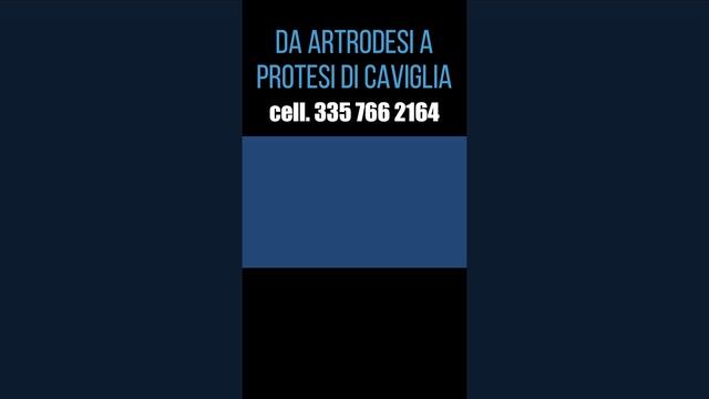 Artrodesi o protesi di caviglia | Dott. Andrea Scala specialista della caviglia e del piede |#Short смотреть онлайн