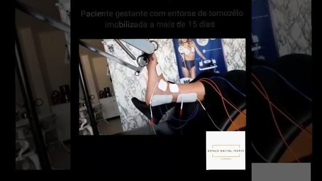 Entorse de tornozêlo em gestante смотреть онлайн