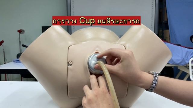 Vacuum Extraction delivery Medicine CMU смотреть онлайн