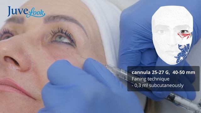 Treatment protocol Juvelook. смотреть онлайн