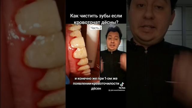 #стоматолог #стоматология #десна #чистказубов #чистка #гигиенаполостирта #гигиена #зубнойкамень #зу смотреть онлайн