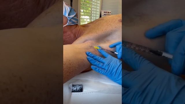 Sweaty Armpits Or Hands? Botox Injections Can Help!