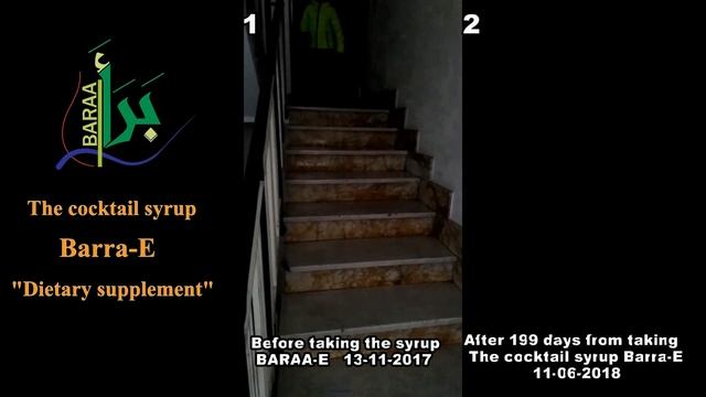 3 Quick results for the treatment of genetic DMD Deletion of exon 52 with nutrition смотреть онлайн