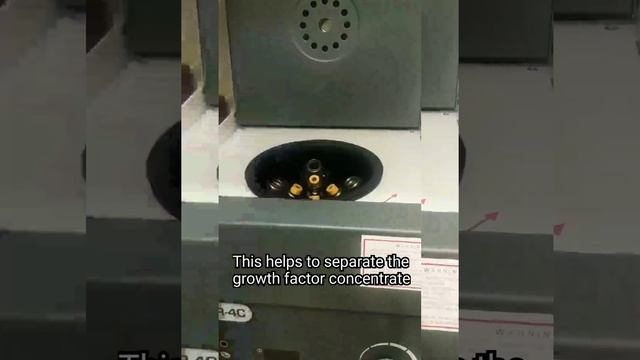 PLATELET RICH PLASMA THERAPY or GROWTH FACTOR CONCENTRATE - for hair loss/hair fall, face anti agin смотреть онлайн