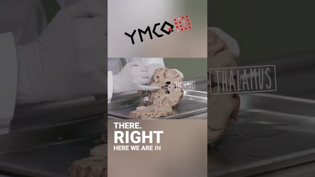 Exploring The Fascinating Brain: Thalamus, Pons, And Midbrain | Neuroanatomy Dessication