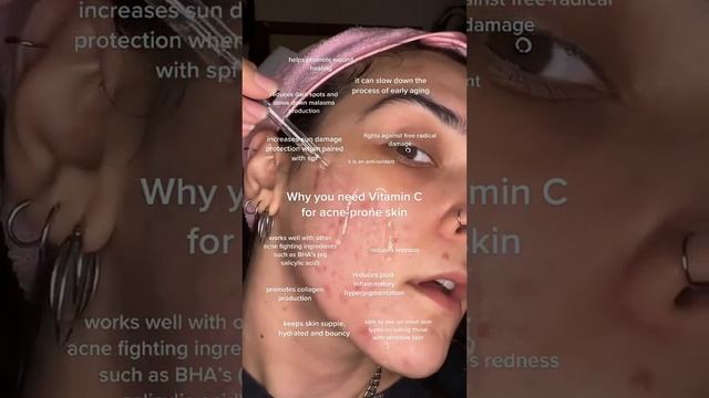 THESE are the reasons you NEED Vitamin C for Acne Prone Skin смотреть онлайн