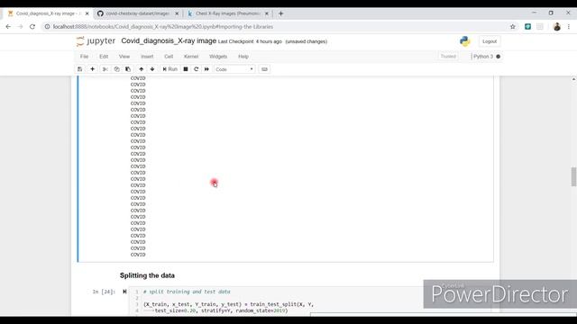 Detect COVID19 from chest X-ray || Deep Learning algorithm to detect corona from chest X-ray images смотреть онлайн