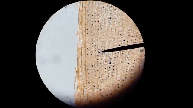 Onion root tip anaphase 400x and 1000x magnification смотреть онлайн