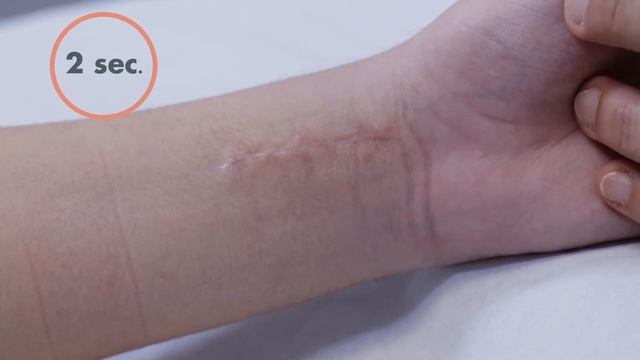 Eau Thermale Avène | Cicalfate+ Gel Για Τις Ουλές - Τεχνικές Μασάζ смотреть онлайн