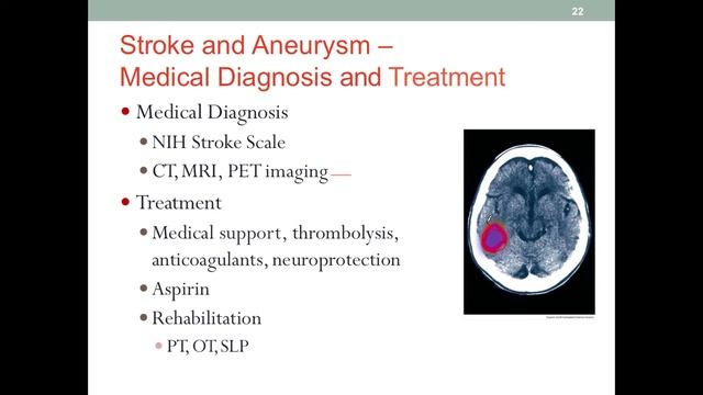MNT Stroke смотреть онлайн