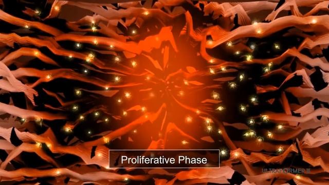 ULTRAFORMER III High Intensity Focused Ultrasound
